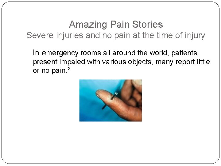 Amazing Pain Stories Severe injuries and no pain at the time of injury In