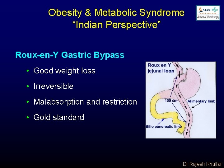 Obesity & Metabolic Syndrome “Indian Perspective” Roux-en-Y Gastric Bypass • Good weight loss •