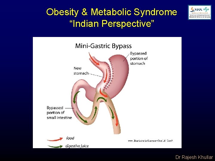 Obesity & Metabolic Syndrome “Indian Perspective” Dr Rajesh Khullar 