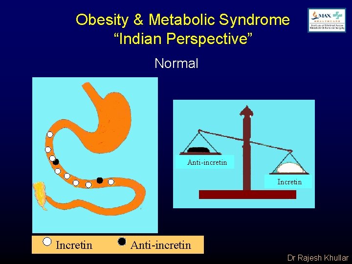 Obesity & Metabolic Syndrome “Indian Perspective” Normal Anti-incretin Incretin tinm Incretin Anti-incretin Dr Rajesh