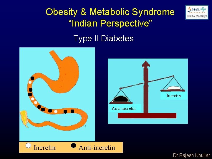 Obesity & Metabolic Syndrome “Indian Perspective” Type II Diabetes Incretin Anti-incretin tinm Incretin Anti-incretin