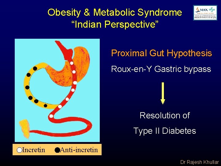 Obesity & Metabolic Syndrome “Indian Perspective” Proximal Gut Hypothesis Roux-en-Y Gastric bypass Resolution of