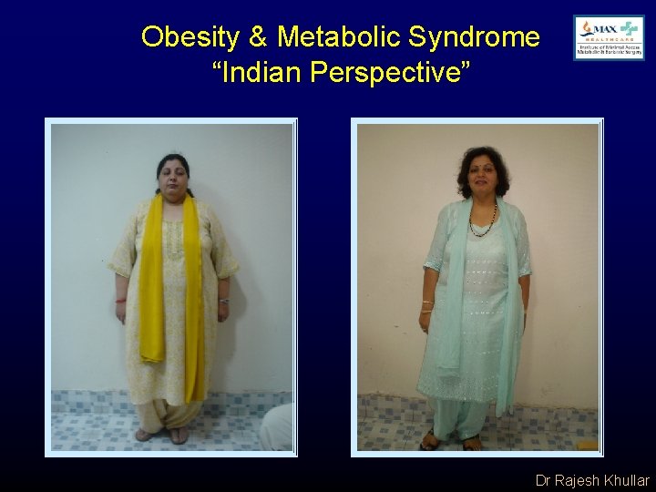 Obesity & Metabolic Syndrome “Indian Perspective” Dr Rajesh Khullar 