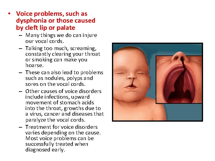  • Voice problems, such as dysphonia or those caused by cleft lip or