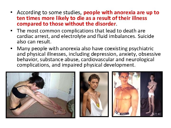  • According to some studies, people with anorexia are up to ten times