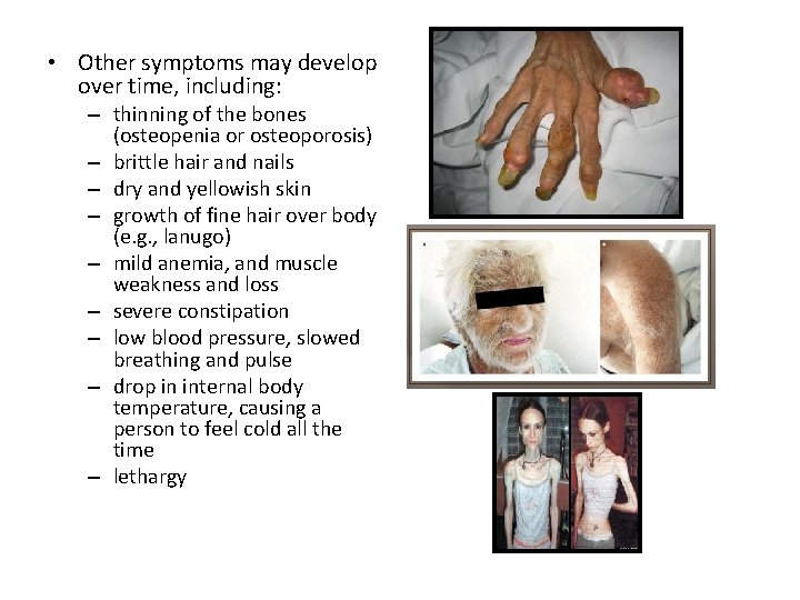 • Other symptoms may develop over time, including: – thinning of the bones