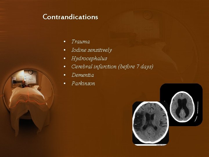 Contrandications • • • Trauma Iodine sensitively Hydrocephalus Cerebral infarction (before 7 days) Dementia