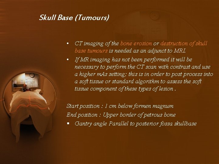 Skull Base (Tumours) • CT imaging of the bone erosion or destruction of skull