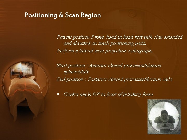 Positioning & Scan Region Patient position Prone, head in head rest with chin extended