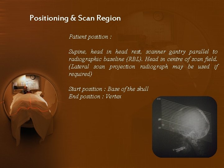 Positioning & Scan Region Patient position : Supine, head in head rest, scanner gantry