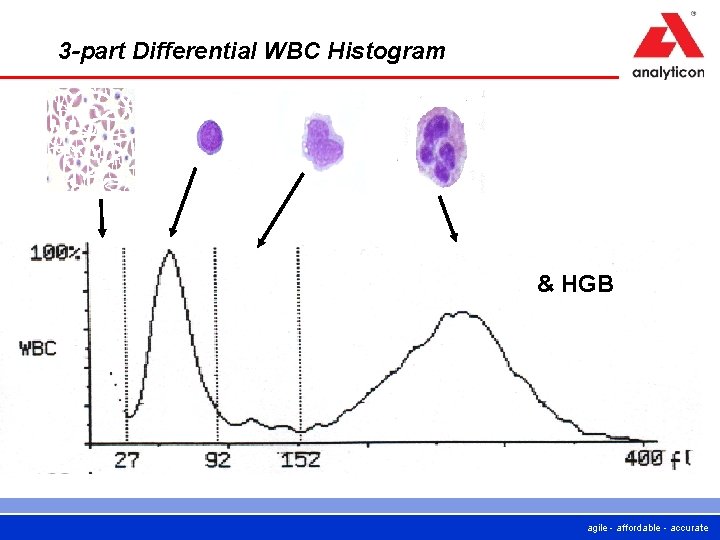 3 -part Differential WBC Histogram & HGB agile - affordable - accurate 