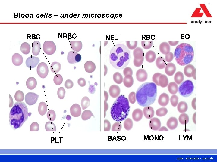 Blood cells – under microscope RBC NRBC PLT NEU BASO RBC MONO EO LYM