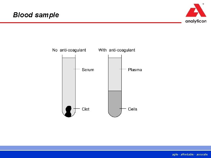 Blood sample agile - affordable - accurate 