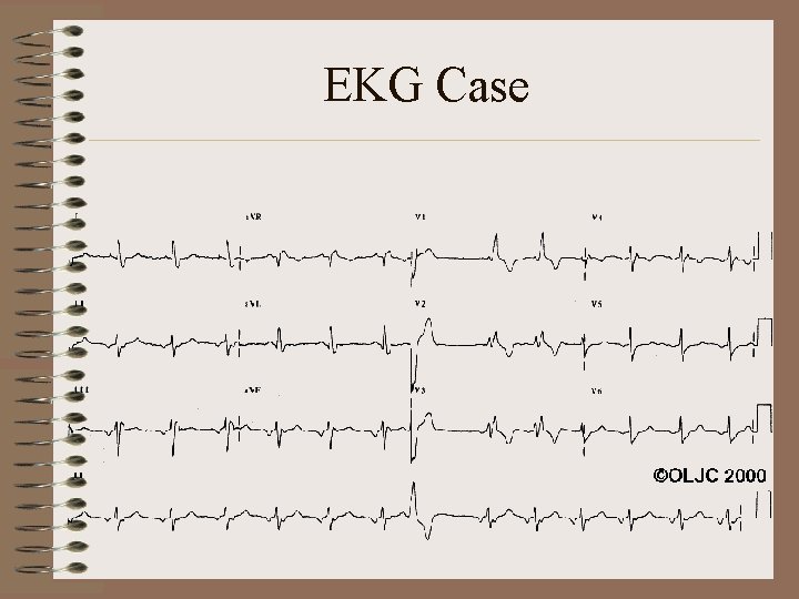 EKG Case 
