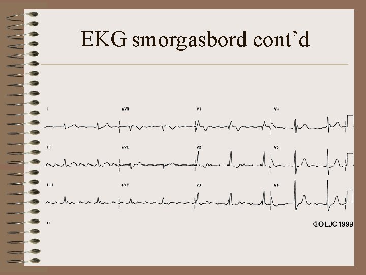 EKG smorgasbord cont’d 