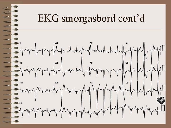 EKG smorgasbord cont’d 