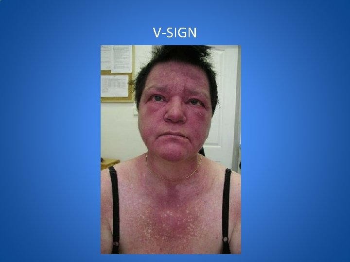 V-SIGN 