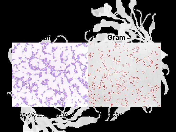 Bacterial Cell Walls Gram + Staphylococcus aureus Gram - Escherischia coli 