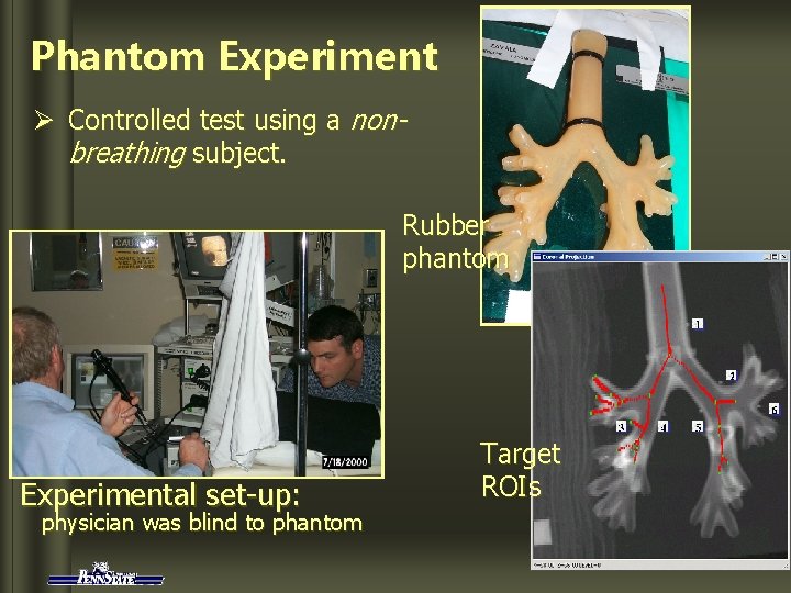 Phantom Experiment Ø Controlled test using a nonbreathing subject. Rubber phantom Experimental set-up: physician