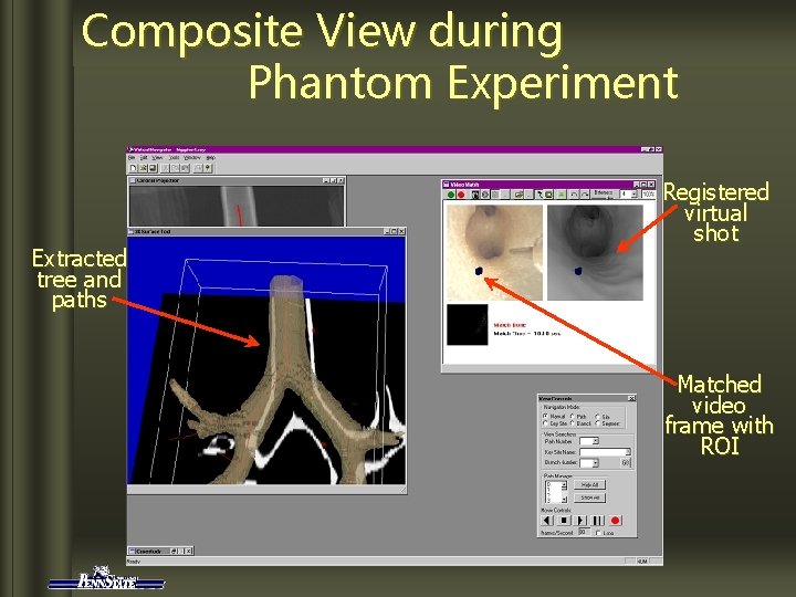 Composite View during Phantom Experiment Extracted tree and paths Registered virtual shot Matched video