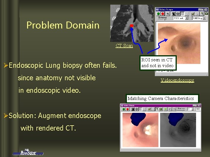 Problem Domain CT Scan ØEndoscopic Lung biopsy often fails. since anatomy not visible ROI