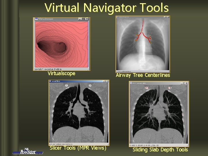 Virtual Navigator Tools Virtualscope Slicer Tools (MPR Views) Airway Tree Centerlines Sliding Slab Depth