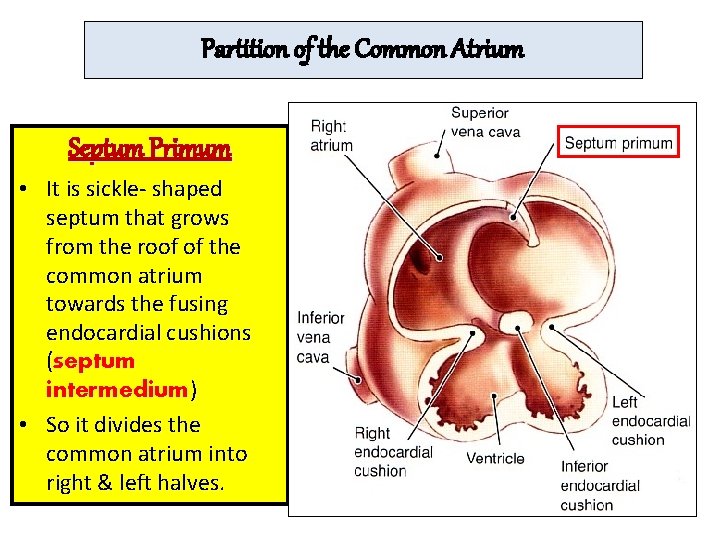 Partition of the Common Atrium Septum Primum • It is sickle- shaped septum that