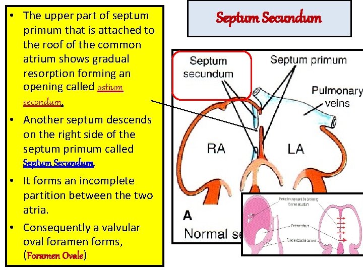  • The upper part of septum primum that is attached to the roof