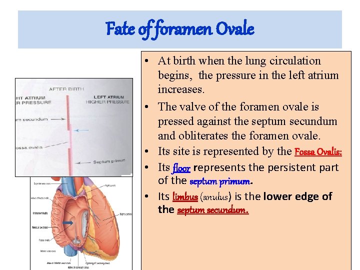 Fate of foramen Ovale • At birth when the lung circulation begins, the pressure