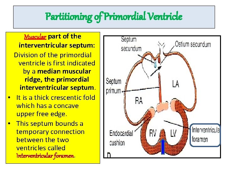 Partitioning of Primordial Ventricle Muscular part of the interventricular septum: Division of the primordial
