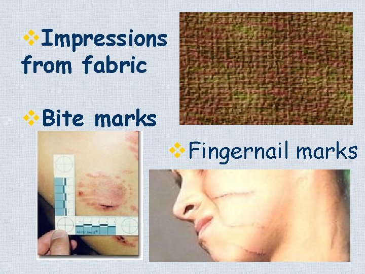 v. Impressions from fabric v. Bite marks v. Fingernail marks 