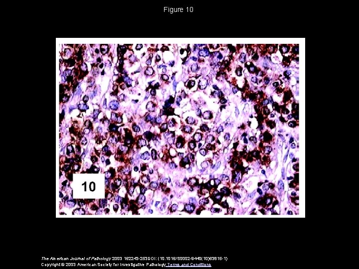 Figure 10 The American Journal of Pathology 2003 162243 -253 DOI: (10. 1016/S 0002