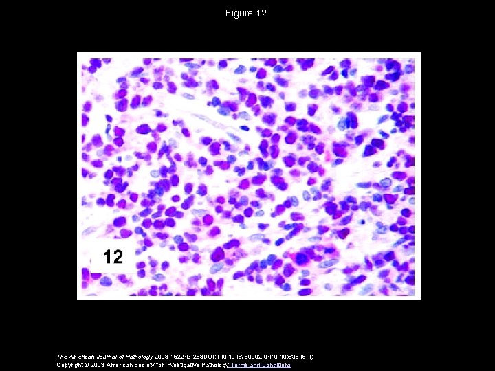 Figure 12 The American Journal of Pathology 2003 162243 -253 DOI: (10. 1016/S 0002