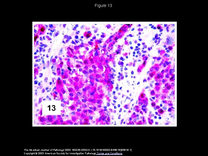 Figure 13 The American Journal of Pathology 2003 162243 -253 DOI: (10. 1016/S 0002