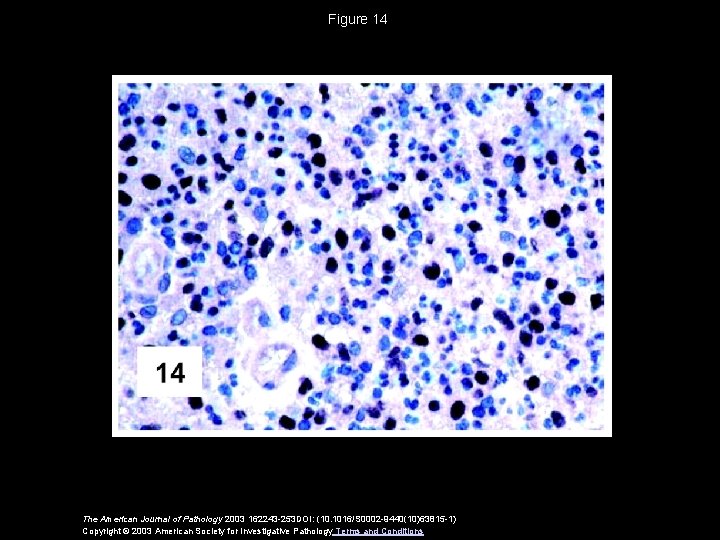 Figure 14 The American Journal of Pathology 2003 162243 -253 DOI: (10. 1016/S 0002