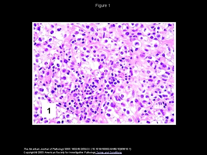 Figure 1 The American Journal of Pathology 2003 162243 -253 DOI: (10. 1016/S 0002