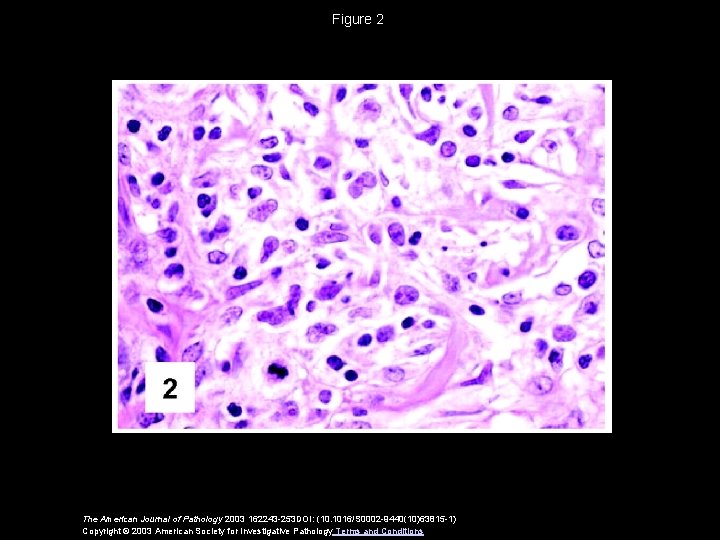 Figure 2 The American Journal of Pathology 2003 162243 -253 DOI: (10. 1016/S 0002