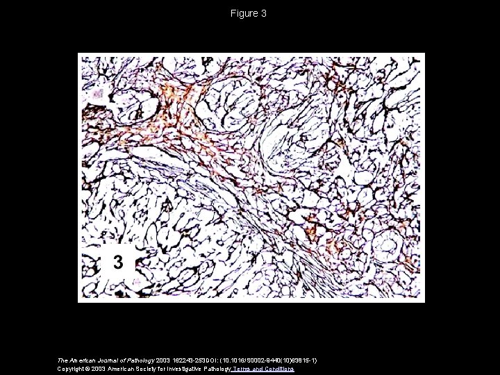 Figure 3 The American Journal of Pathology 2003 162243 -253 DOI: (10. 1016/S 0002