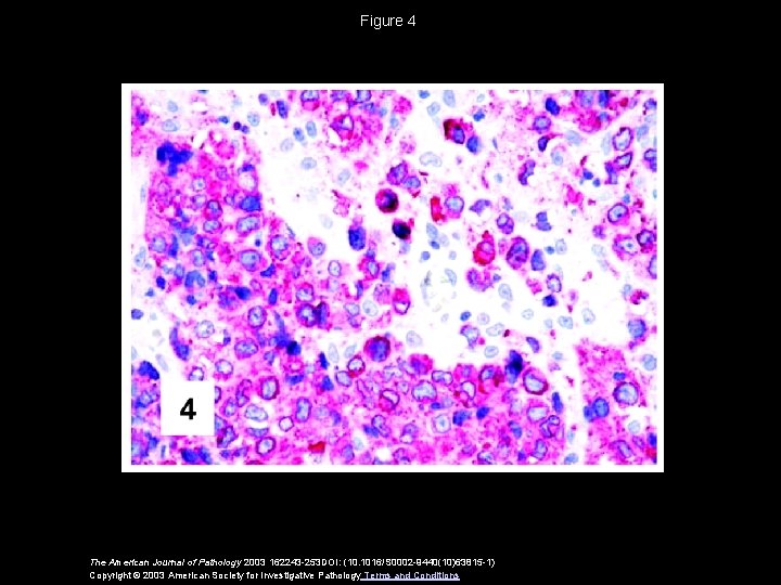 Figure 4 The American Journal of Pathology 2003 162243 -253 DOI: (10. 1016/S 0002