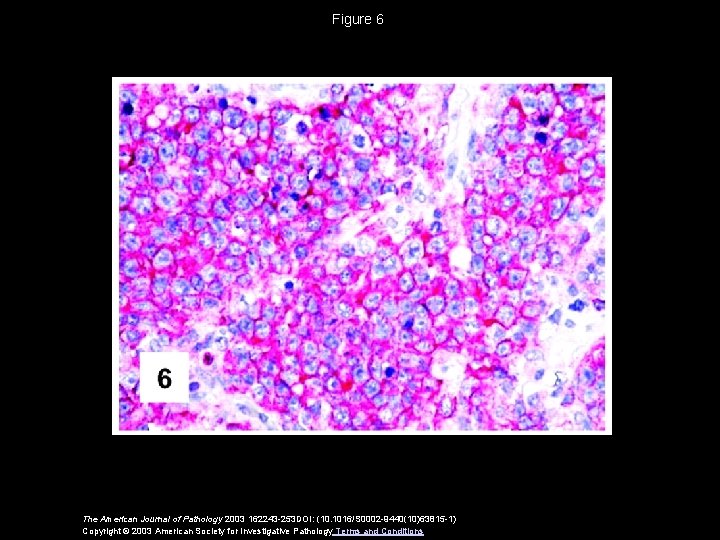 Figure 6 The American Journal of Pathology 2003 162243 -253 DOI: (10. 1016/S 0002