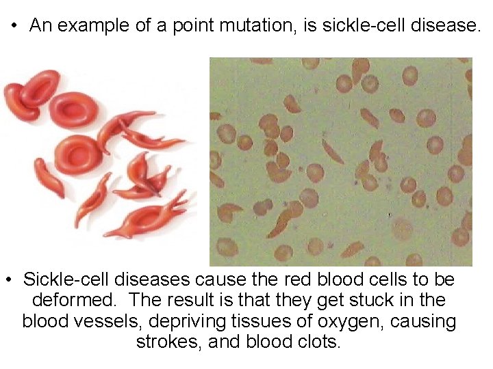  • An example of a point mutation, is sickle-cell disease. • Sickle-cell diseases