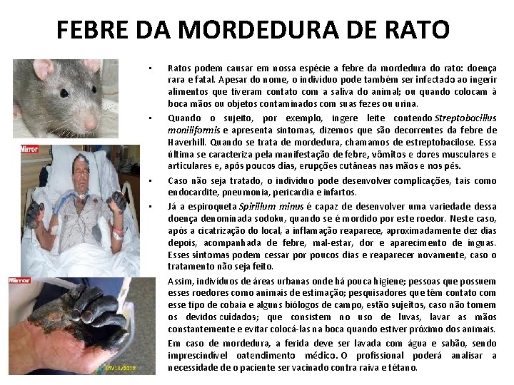 FEBRE DA MORDEDURA DE RATO • • • Ratos podem causar em nossa espécie