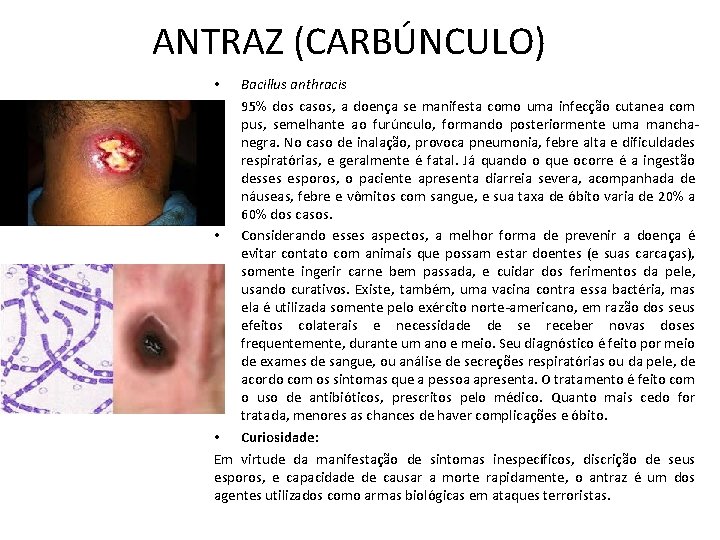 ANTRAZ (CARBÚNCULO) Bacillus anthracis 95% dos casos, a doença se manifesta como uma infecção