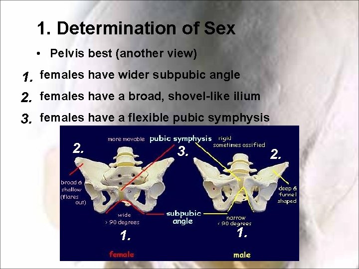 1. Determination of Sex • Pelvis best (another view) 1. females have wider subpubic