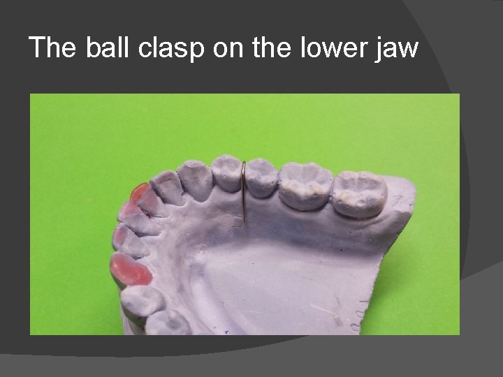 The ball clasp on the lower jaw 