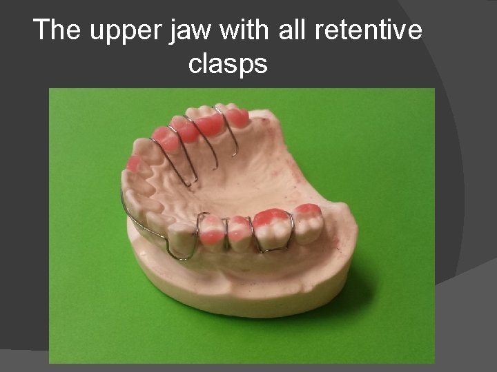 The upper jaw with all retentive clasps 