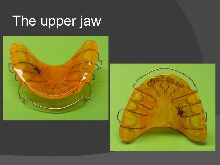 The upper jaw 