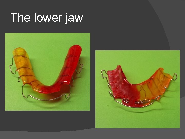 The lower jaw 
