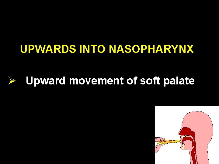 UPWARDS INTO NASOPHARYNX Ø Upward movement of soft palate 