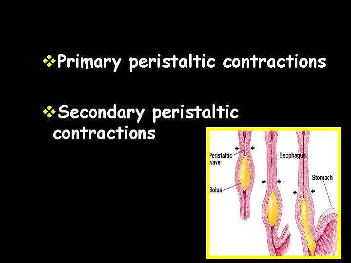 v. Primary peristaltic contractions v. Secondary peristaltic contractions 